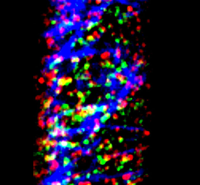 Rainbow colored fluorescent tagged proteins